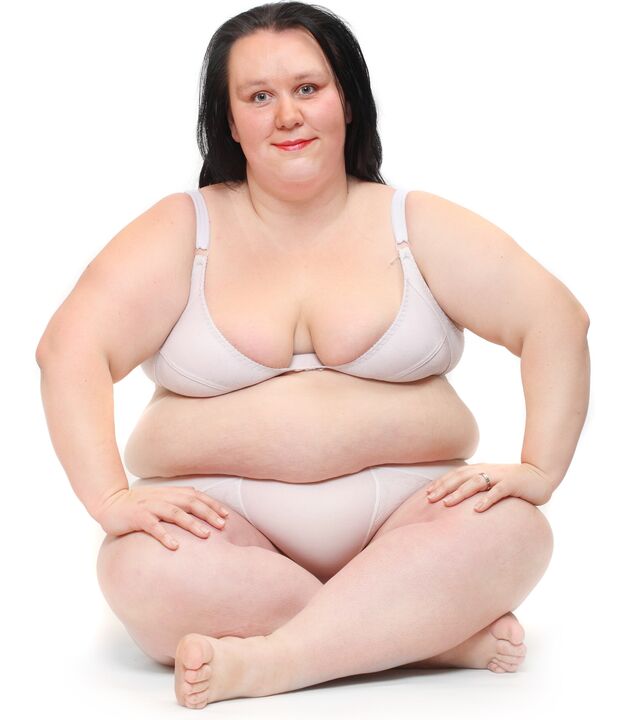 Overweight woman